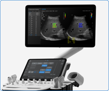 삼성 메디슨 V6 초음파 장비